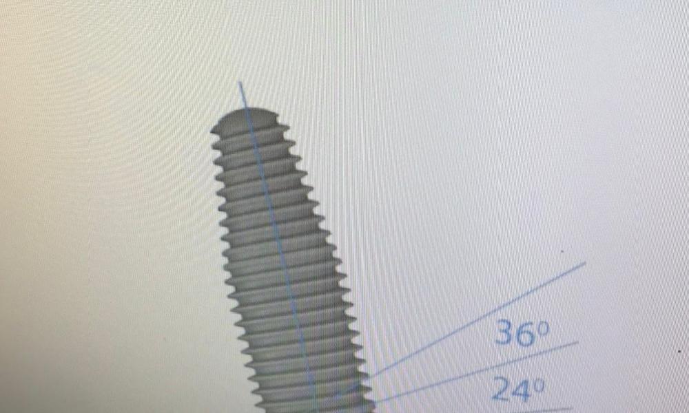 IMPIANTI DENTALI ANGOLATI PADOVA