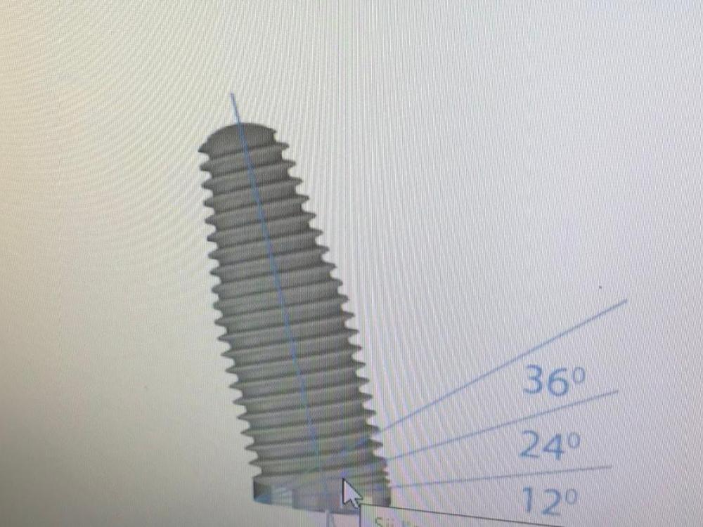 IMPIANTI DENTALI ANGOLATI PADOVA