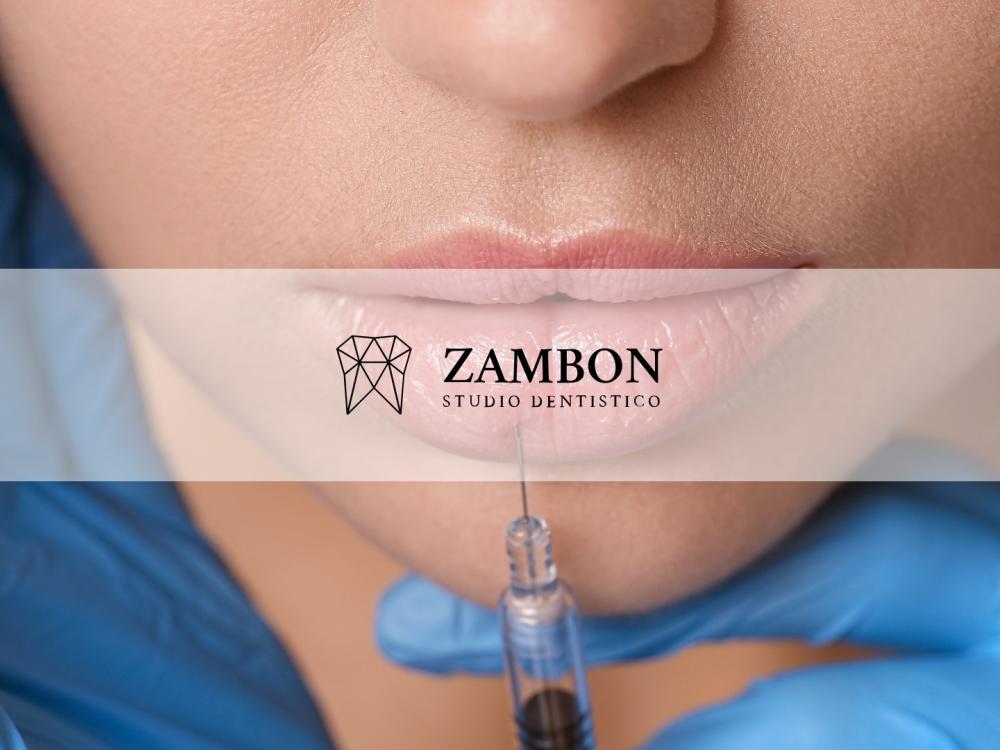 Trattamento Filler Labbra Padova