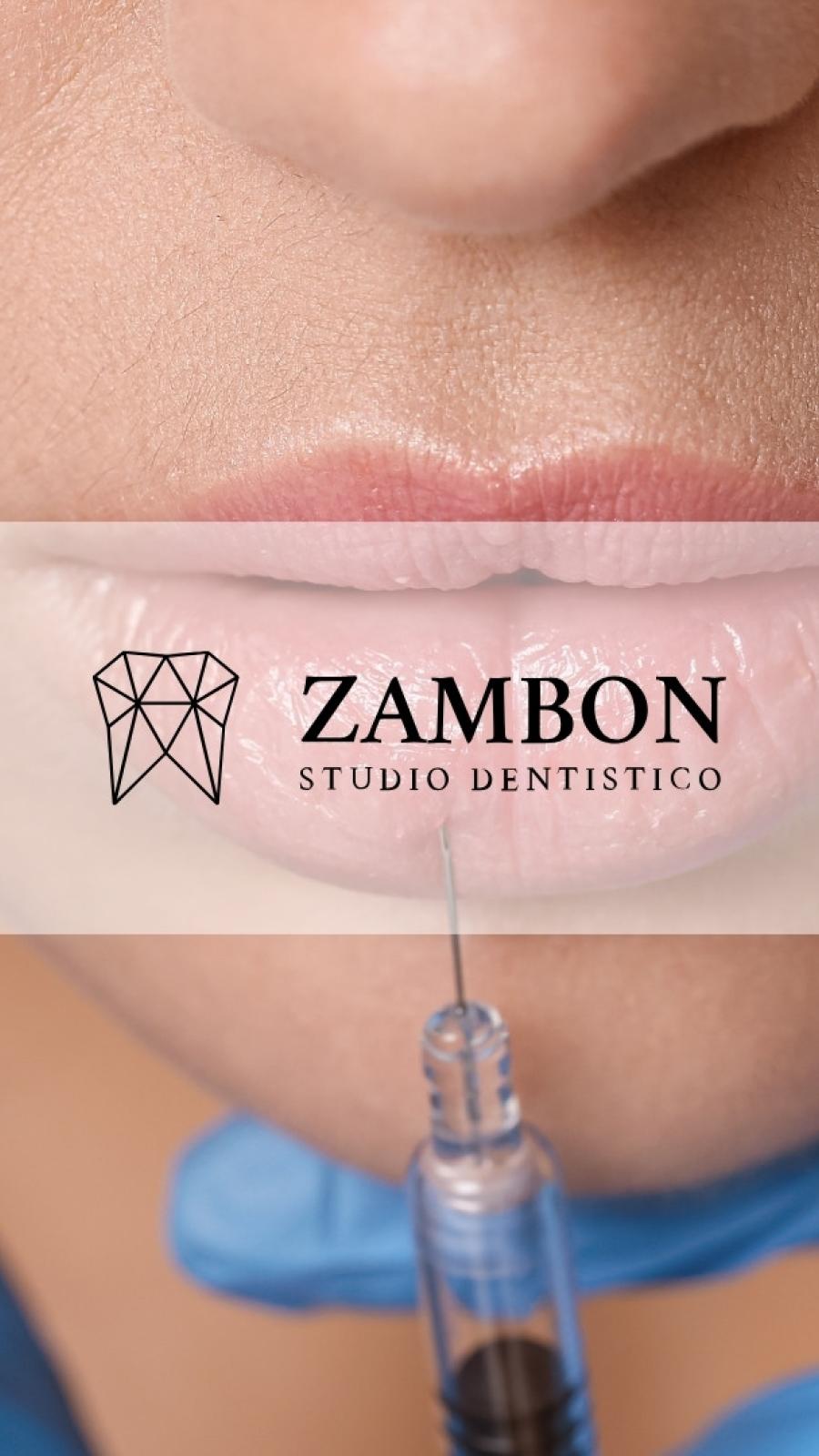 Trattamento Filler Labbra Padova